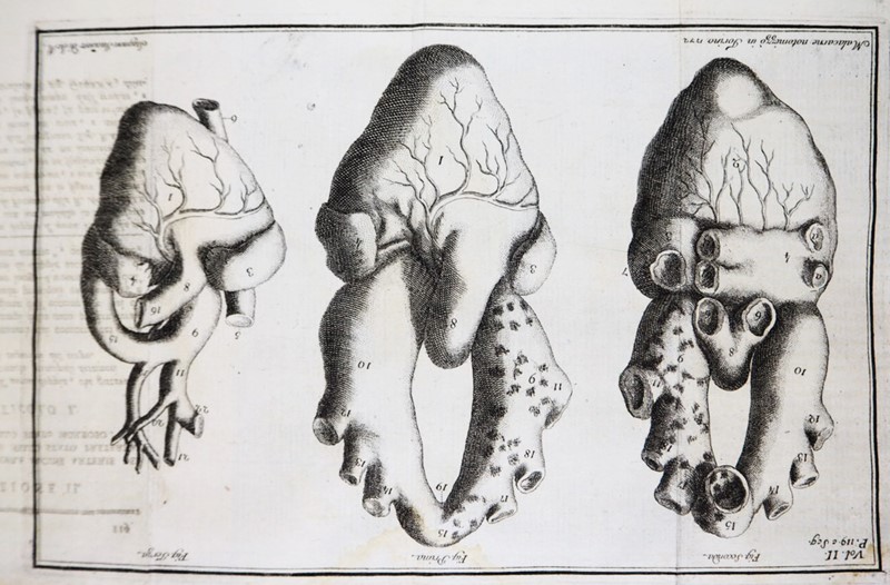 Medicine/Surgery. MALACARNE. Delle Osservazioni di Chirurgia.  - Auction RARE ANTIQUE  [..]